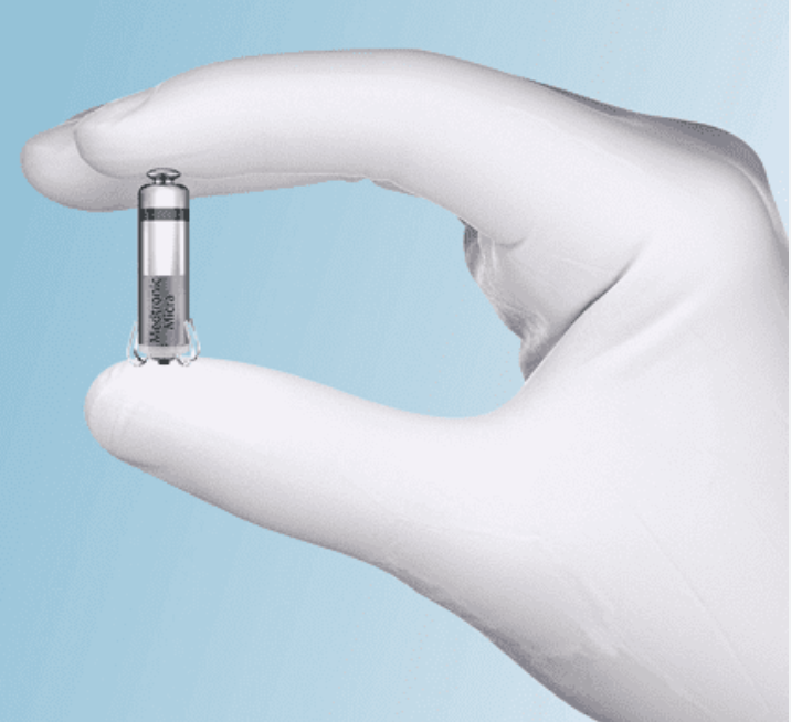 All’Ospedale di Agrigento mini pacemaker senza fili impiantato a una giovane in gravidanza